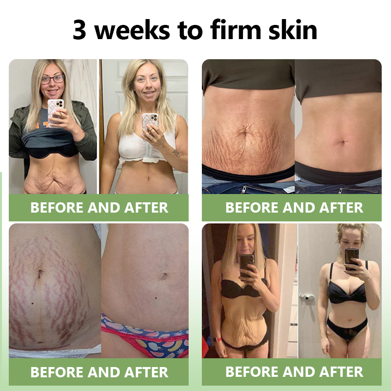 💜STDEI™ Luxuriöse Kollagen Straffungscreme (🔥70 % Rabatt für kurze Zeit!)🥑