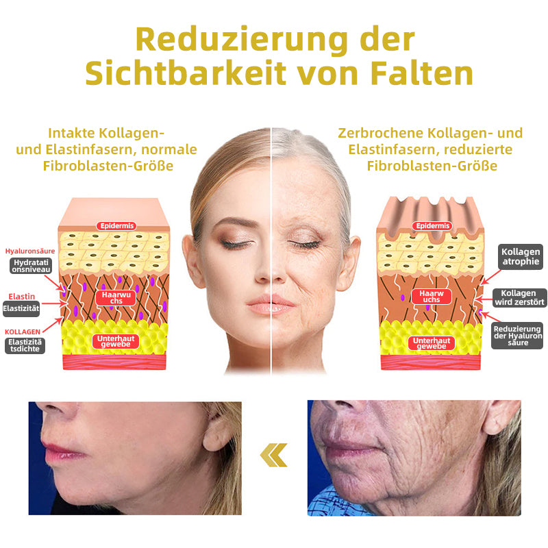 📒Flysmus® Hautstraffende Creme, Adressierung Krepp & Sagging