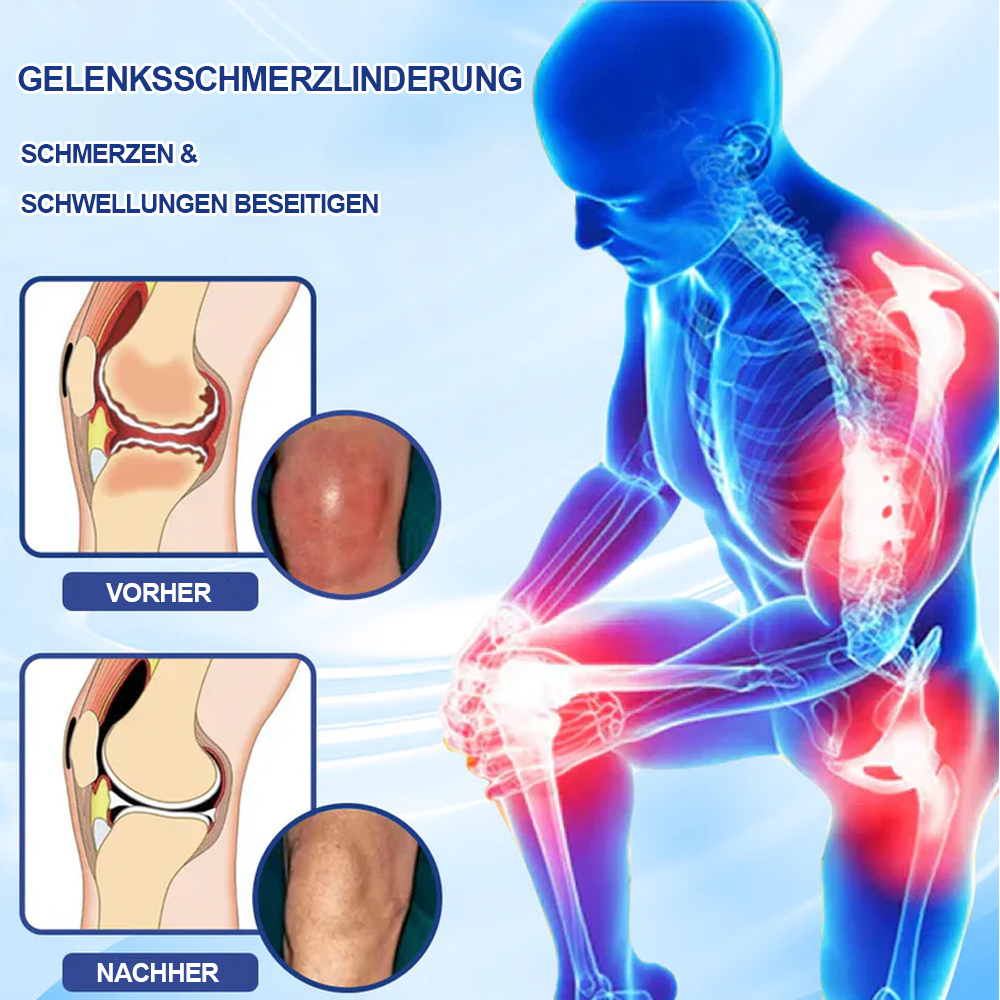 ✅Offizieller Store: Ourlyard® Magnesium Schmerzheilende Knochencreme (Behandlung für Arthritis, Neuropathie, rheumatische Erkrankungen, Muskelkrämpfe, Zuckungen und Sportverletzungen