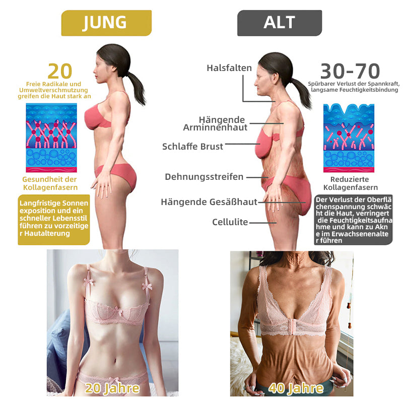 📒Flysmus® Hautstraffende Creme, Adressierung Krepp & Sagging