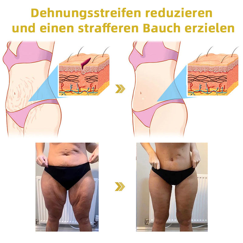 📒Flysmus® Hautstraffende Creme, Adressierung Krepp & Sagging
