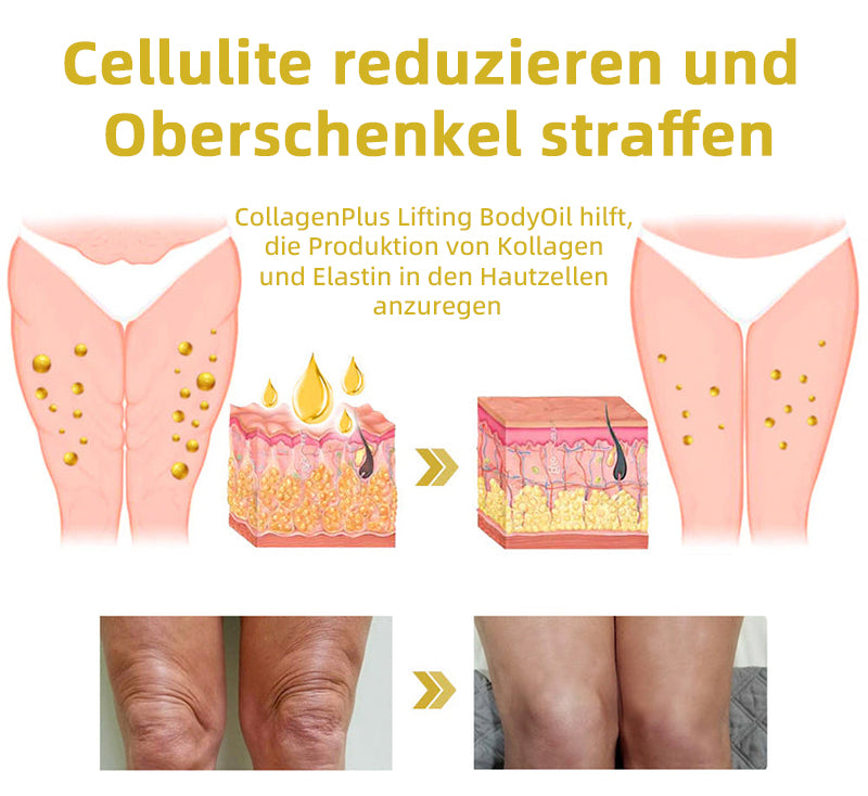 📒Flysmus® Hautstraffende Creme, Adressierung Krepp & Sagging
