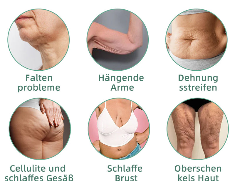 📒Flysmus® Hautstraffende Creme, Adressierung Krepp & Sagging