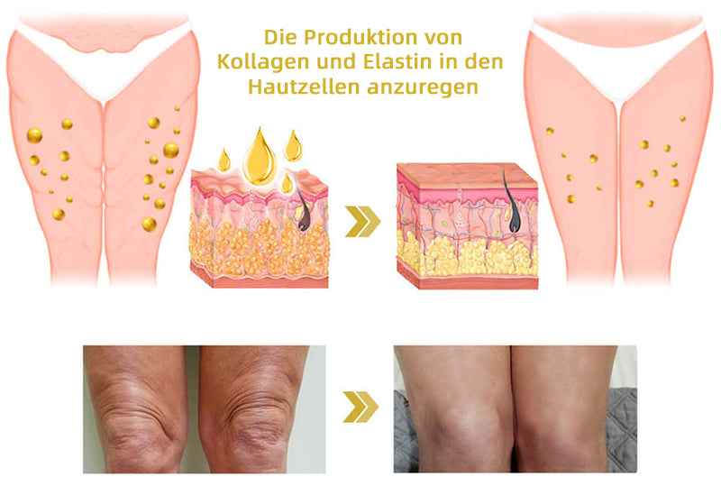 📒Flysmus® Hautstraffende Creme, Adressierung Krepp & Sagging