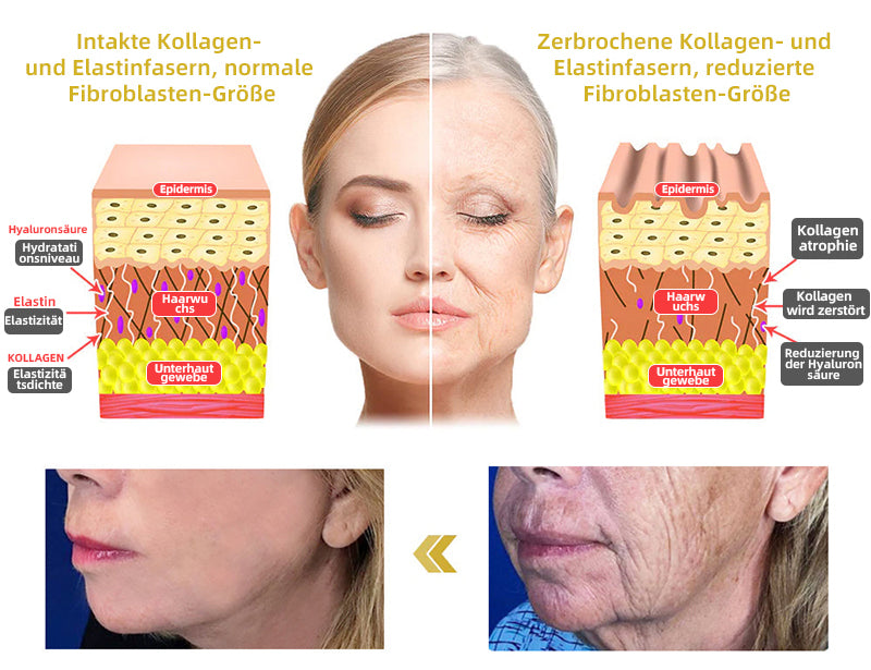 📒Flysmus® Hautstraffende Creme, Adressierung Krepp & Sagging