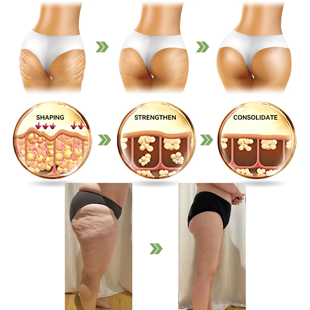 💜STDEI™ Luxuriöse Kollagen Straffungscreme (🔥70 % Rabatt für kurze Zeit!)🥑