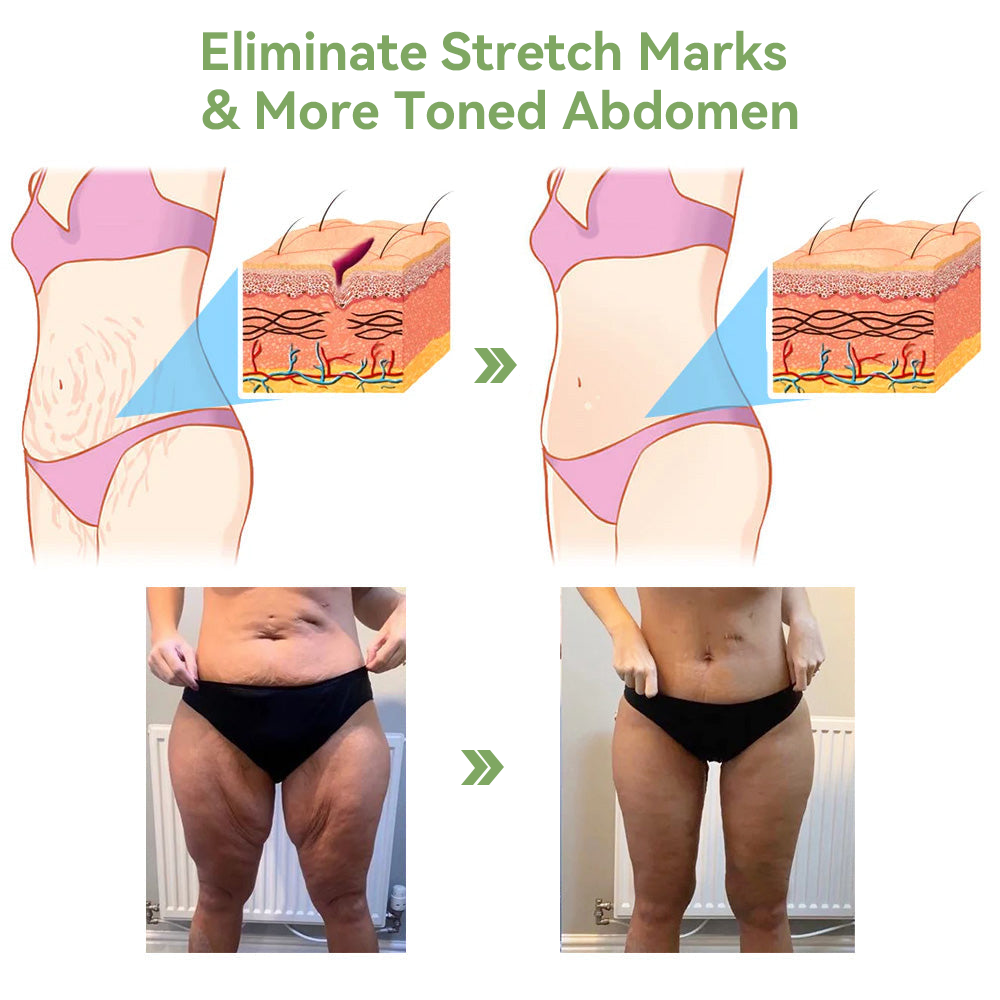 💜STDEI™ Luxuriöse Kollagen Straffungscreme (🔥70 % Rabatt für kurze Zeit!)🥑