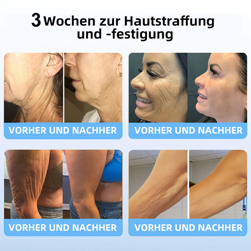 📒Flysmus® Hautstraffende Creme, Adressierung Krepp & Sagging