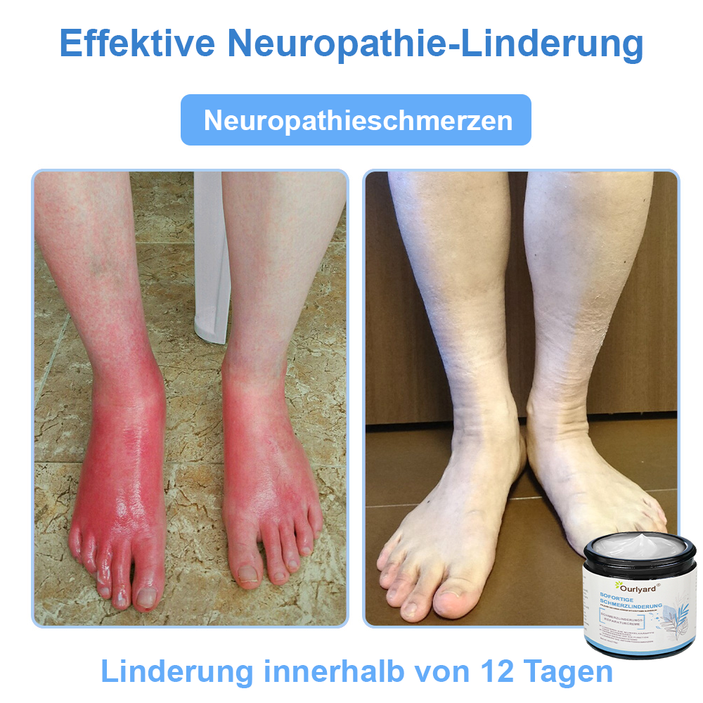 ✨✨Ourlyard® Magnesium Schmerzheilende Knochencreme (Behandlung für Arthritis, Neuropathie, rheumatische Erkrankungen, Muskelkrämpfe, Sportverletzungen und Zuckungen)