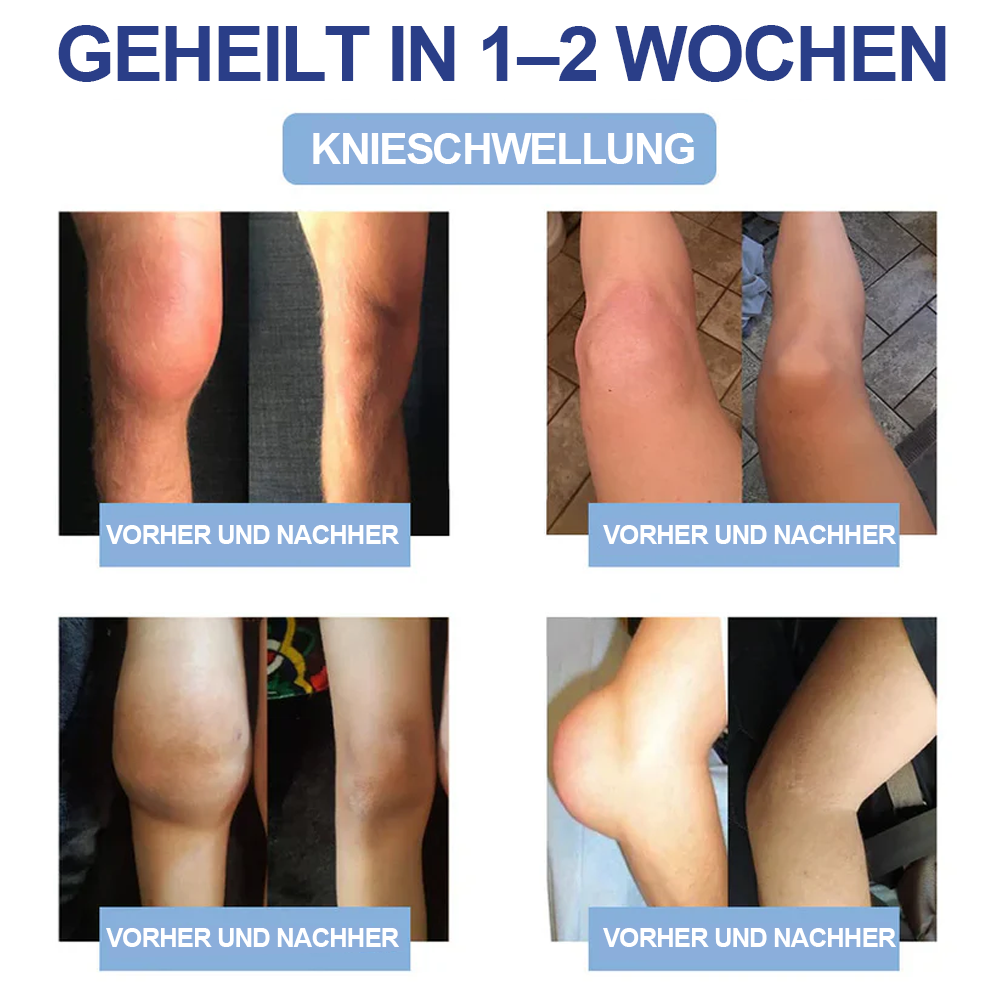 ✅Offizieller Store: Ourlyard® Magnesium Schmerzheilende Knochencreme (Behandlung für Arthritis, Neuropathie, rheumatische Erkrankungen, Muskelkrämpfe, Zuckungen und Sportverletzungen