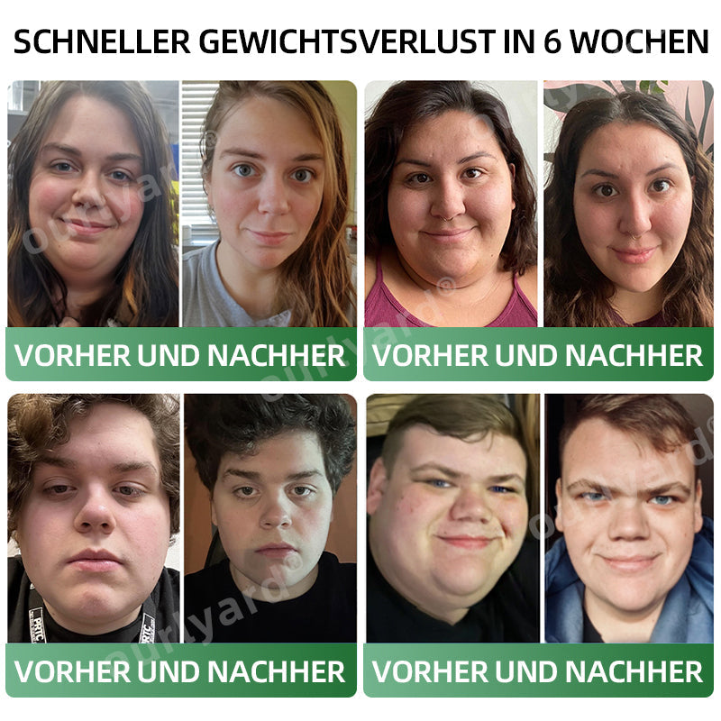 🧑⚕️🍃Ourlyard® Meglutide Abnehm- und Gesundheitsfördernde Tropfen - Hergestellt und Versand aus Deutschland👩⚕️ (Copy)