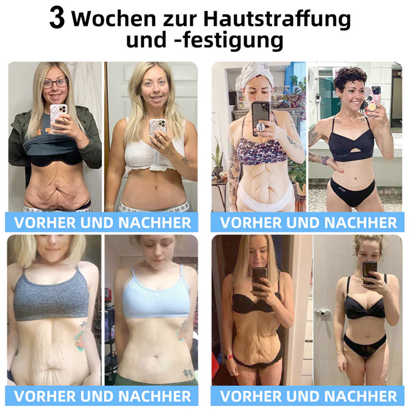 📒Flysmus® Hautstraffende Creme, Adressierung Krepp & Sagging