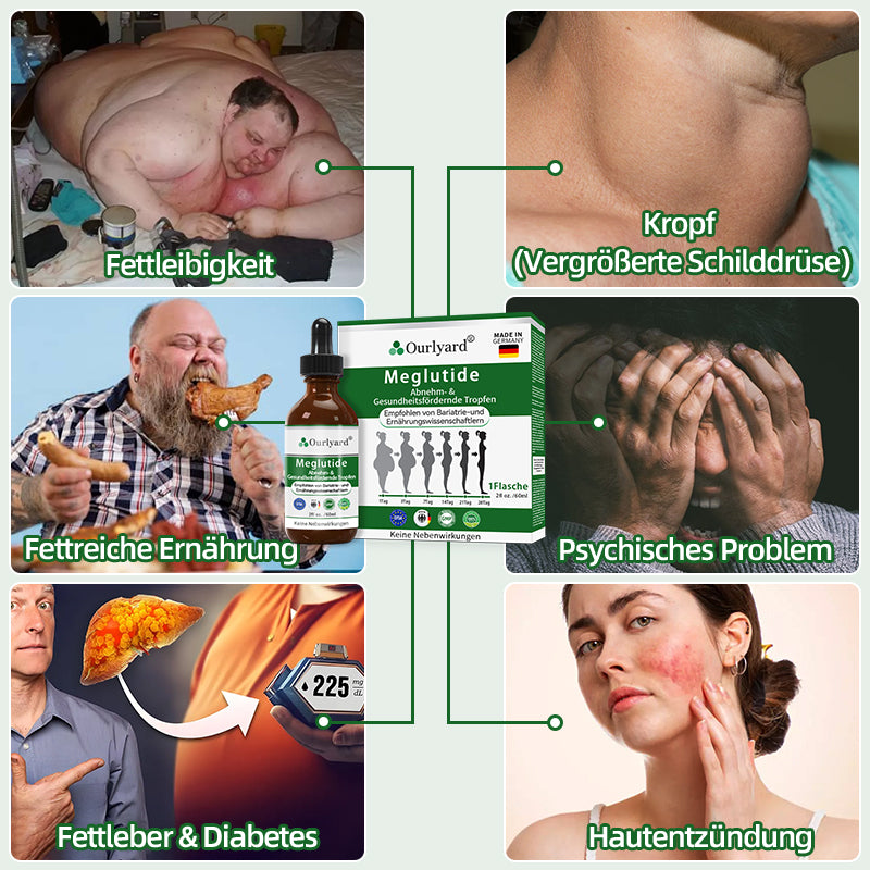 🧑⚕️🍃Ourlyard® Meglutide Abnehm- und Gesundheitsfördernde Tropfen - Hergestellt und Versand aus Deutschland👩⚕️ (Copy)