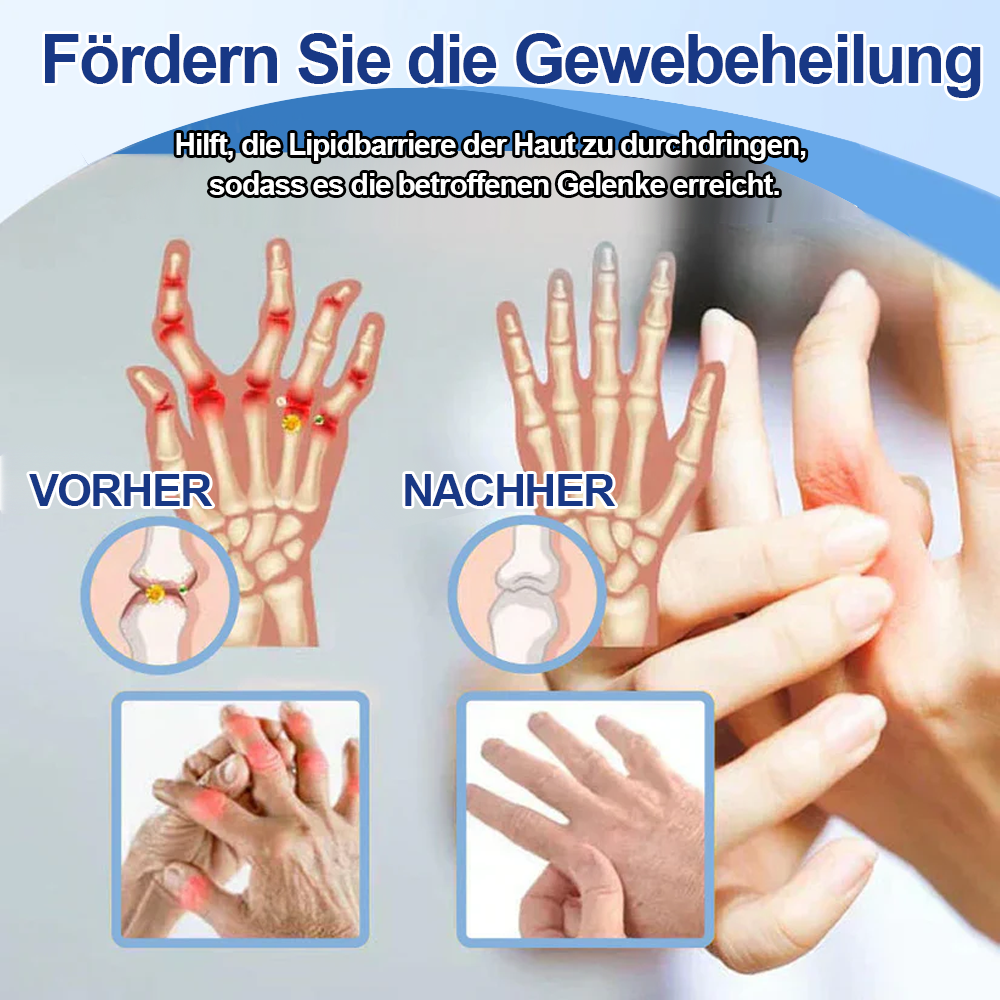 ✅Offizieller Store: Ourlyard® Magnesium Schmerzheilende Knochencreme (Behandlung für Arthritis, Neuropathie, rheumatische Erkrankungen, Muskelkrämpfe, Zuckungen und Sportverletzungen