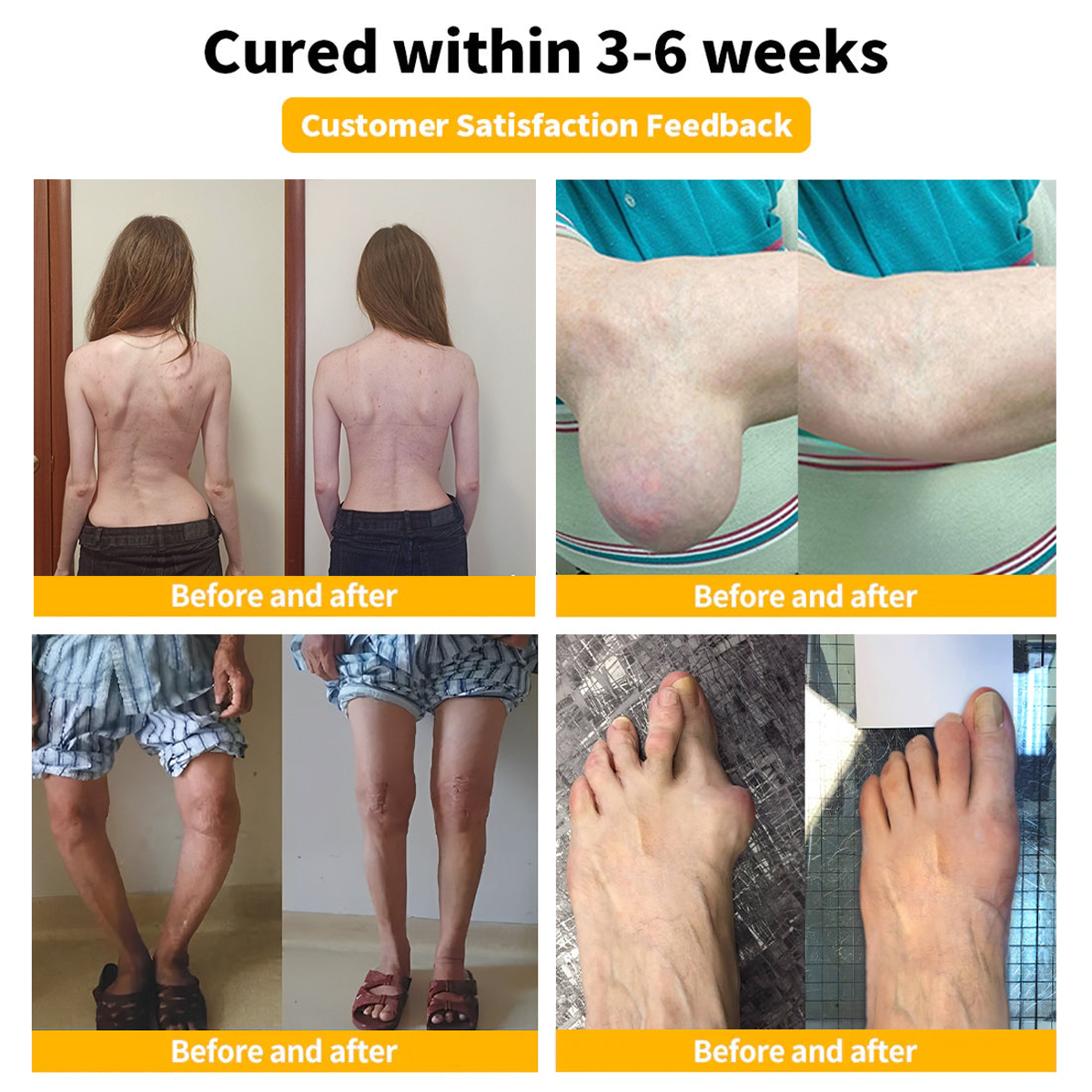 đŒđ„FurzeroâąBienengift Schmerz- und Knochenheilungscreme (Besonders geeignet fĂŒr Ă€ltere Menschen und zur Behandlung von Arthritis)