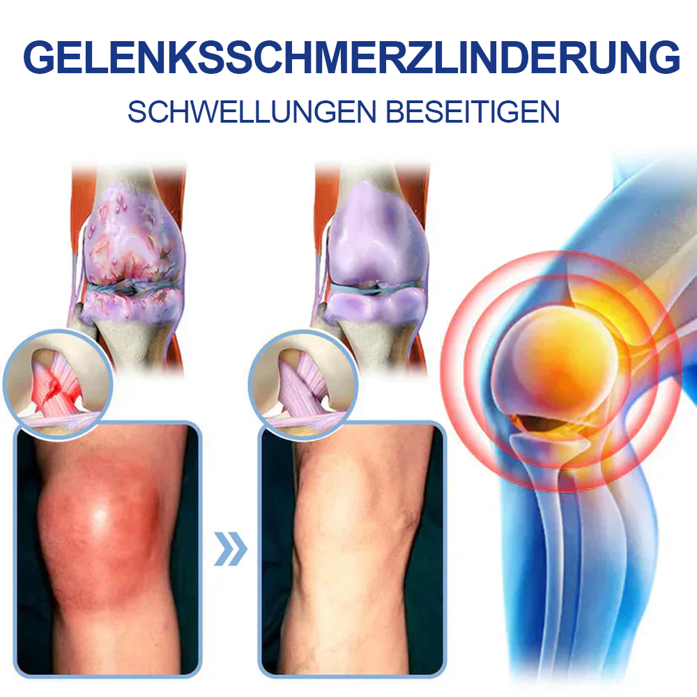 ✅Offizieller Store: Ourlyard® Magnesium Schmerzheilende Knochencreme (Behandlung für Arthritis, Neuropathie, rheumatische Erkrankungen, Muskelkrämpfe, Zuckungen und Sportverletzungen