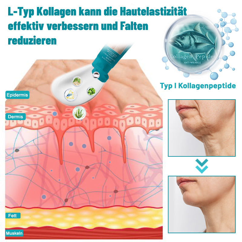 📒Flysmus® Hautstraffende Creme, Adressierung Krepp & Sagging