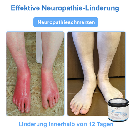 ✨✨Ourlyard® Magnesium Schmerzheilende Knochencreme (Behandlung für Arthritis, Neuropathie, rheumatische Erkrankungen, Muskelkrämpfe, Sportverletzungen und Zuckungen)