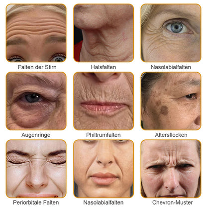 🐝🍀Hergestellt in Deutschland - ✨Furzero™ Botox Bienenvenom Faltenentfernungscreme