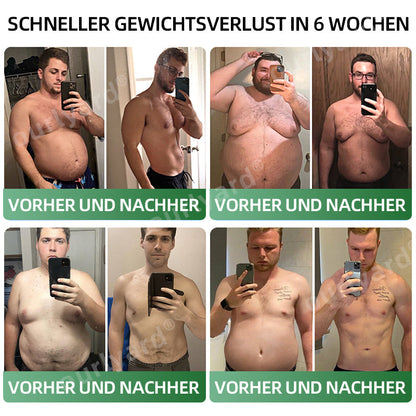 🧑‍⚕️🍃Ourlyard® Meglutide Abnehm- und Gesundheitsfördernde Tropfen - Hergestellt und Versand aus Deutschland👩‍⚕️ (Copy)