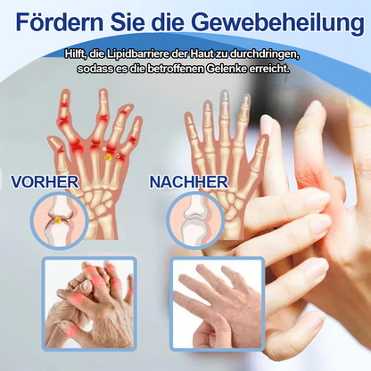 ✅Offizieller Store: Ourlyard® Magnesium Schmerzheilende Knochencreme (Behandlung für Arthritis, Neuropathie, rheumatische Erkrankungen, Muskelkrämpfe, Zuckungen und Sportverletzungen