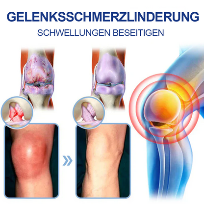 ✅Offizieller Store: Ourlyard® Magnesium Schmerzheilende Knochencreme (Behandlung für Arthritis, Neuropathie, rheumatische Erkrankungen, Muskelkrämpfe, Zuckungen und Sportverletzungen
